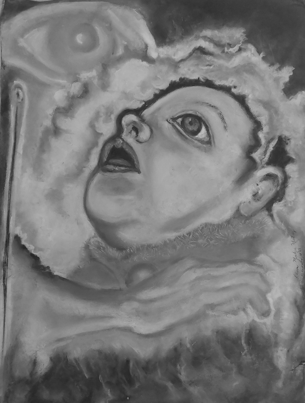 Bebé, dolor y palabras: daño neurológico severo y la discapacidad. Parte 1