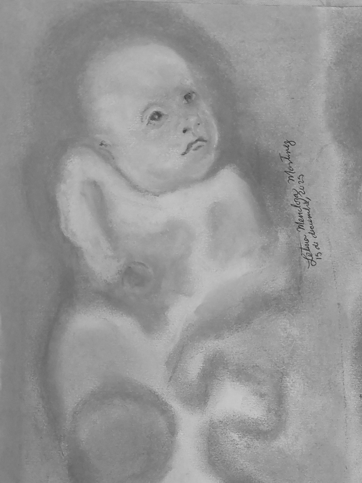 Bebé, dolor y palabras: daño neurológico severo y la discapacidad. Parte 2